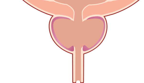 A diagram of a cross-section of a treated prostate gland.