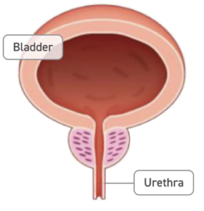 A diagram of the bladder, urethra, and a normal prostate.